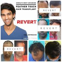 Revert Hair Transplant Centre image 3